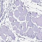 Immunohistochemical staining of human skeletal muscle shows low expression as expected.