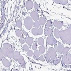 Immunohistochemical staining of human skeletal muscle shows low expression as expected.