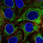 Immunofluorescent staining of human cell line MCF7 shows localization to intermediate filaments.