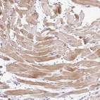 Immunohistochemical staining of human heart muscle shows moderate cytoplasmic positivity in cardiomyocytes.