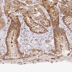 Immunohistochemical staining of human stomach shows moderate cytoplasmic positivity in glandular cells.
