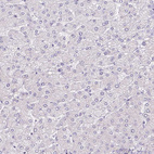 Immunohistochemical staining of human liver shows negative cytoplasmic positivity in hepatocytes as expected.
