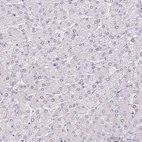 Immunohistochemical staining of human liver shows negative cytoplasmic positivity in hepatocytes as expected.