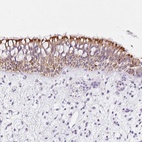 Anti-CARD16 Antibody