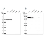 Western blot analysis using Anti-DYNC1I2 antibody HPA053987 (A) shows similar pattern to independent antibody HPA040619 (B).