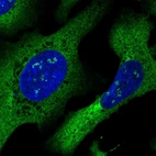Immunofluorescent staining of human cell line U-2 OS shows localization to nucleoli fibrillar center, cytosol & endoplasmic reticulum.