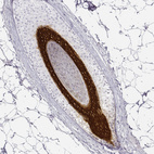 Immunohistochemical staining of human hair shows strong cytoplasmic positivity in cells in internal root sheath.