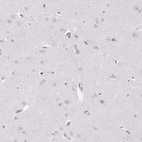Immunohistochemical staining of human cerebral cortex shows no positivity in neuronal cells as expected.