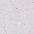Immunohistochemical staining of human cerebral cortex shows no positivity in neuronal cells as expected.
