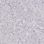 Immunohistochemical staining of human liver shows no positivity in hepatocytes as expected.