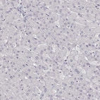 Immunohistochemical staining of human liver shows no positivity in hepatocytes as expected.