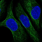 Anti-CNFN Antibody