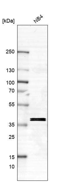 Anti-ST8SIA4 Antibody