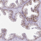 Immunohistochemical staining of human prostate shows strong granular cytoplasmic positivity in glandular cells.
