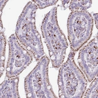 Immunohistochemical staining of human duodenum shows strong granular cytoplasmic positivity in glandular cells.