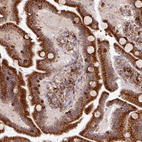 Immunohistochemical staining of human duodenum shows positivity in glandular cells.