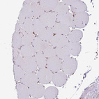 Immunohistochemical staining of human skeletal muscle shows no positivity in myocytes as expected.