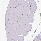 Immunohistochemical staining of human skeletal muscle shows no positivity in myocytes as expected.