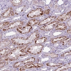 Immunohistochemical staining of human kidney shows strong granular cytoplasmic positivity in cells in tubules.