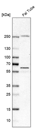 Western blot analysis in human fallopian tube tissue.
