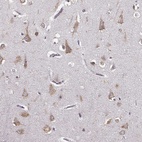 Anti-GABRG3 Antibody