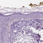 Immunohistochemical staining of human skin shows no positivity in keratinocytes.