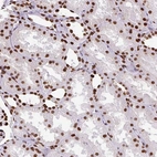 Anti-TMEM184C Antibody