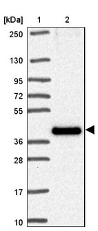 Anti-TMEM184C Antibody