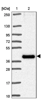 Lane 1: Marker [kDa] 250, 130, 95, 72, 55, 36, 28, 17, 10_br/_Lane 2: Human cell line RT-4