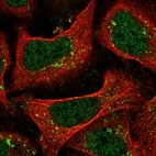 Immunofluorescent staining of human cell line U-2 OS shows localization to nucleoplasm & vesicles.