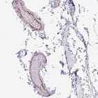 Anti-EML5 Antibody