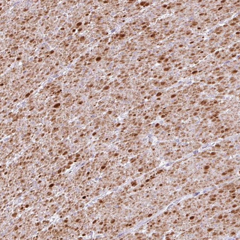 Anti-TRA2A Antibody