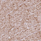 Anti-TRA2A Antibody