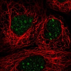 Immunofluorescent staining of human cell line A-431 shows localization to nucleoli.