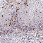 Immunohistochemical staining of human cervix, uterine shows moderate to strong cytoplasmic positivity in Langerhans cells.