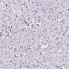 Immunohistochemical staining of human liver shows moderate to strong cytoplasmic positivity in Kupffer cells.