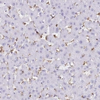 Immunohistochemical staining of human liver shows moderate to strong cytoplasmic positivity in Kupffer cells.