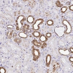Immunohistochemical staining of human kidney shows moderate to strong cytoplasmic positivity in cells in tubules.
