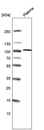 Western blot analysis in human plasma.