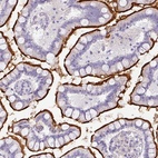 Anti-OR52N1 Antibody