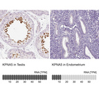 Anti-KPNA5 Antibody