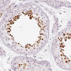 Immunohistochemical staining of human testis shows high expression.