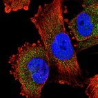 Immunofluorescent staining of human cell line U-251 MG shows localization to cytosol.