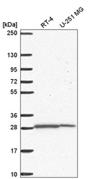 Anti-UPP1 Antibody