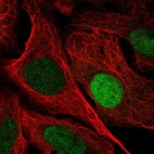 Immunofluorescent staining of human cell line U-2 OS shows localization to nucleoplasm.