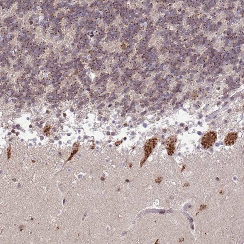 Anti-TMEM246 Antibody