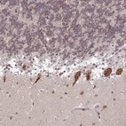 Anti-TMEM246 Antibody
