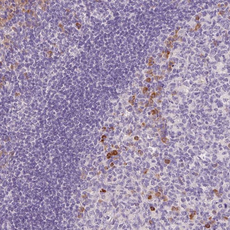 Anti-FAM46C Antibody
