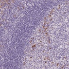 Anti-FAM46C Antibody