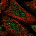 Immunofluorescent staining of human cell line U-2 OS shows localization to nucleoplasm.